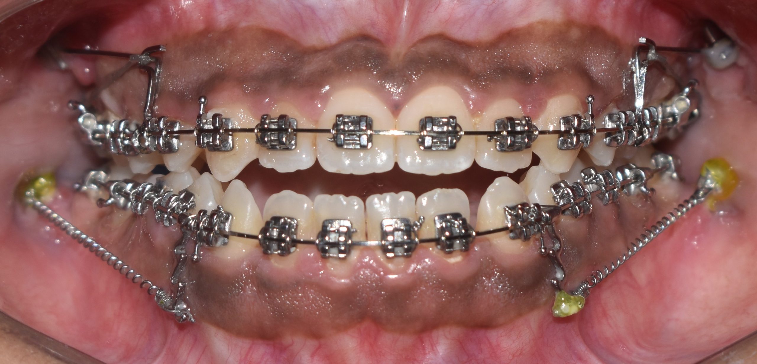 Camouflaging with TADs