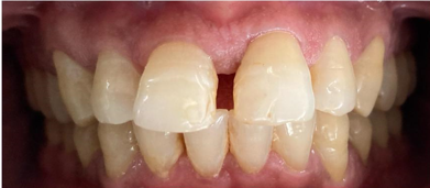 ESTHETIC REHABILITATION